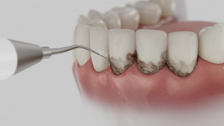 Trusted Teeth Cleaning And Checkup service in Lanai City, HI - Dentist Open Now